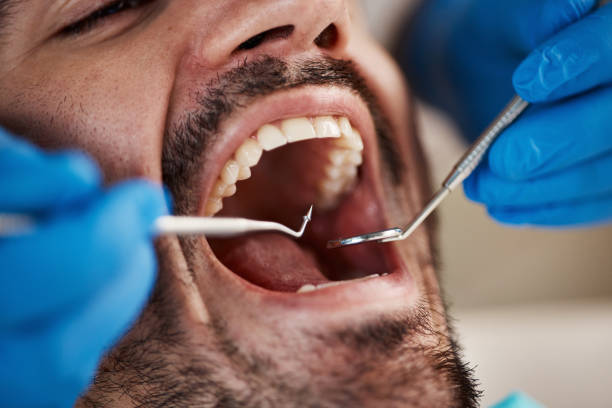 Best Cracked Tooth Emergency Dentist  in Willamina, OR