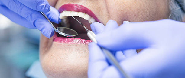 Best Chipped Tooth Repair Near Me  in Willamina, OR